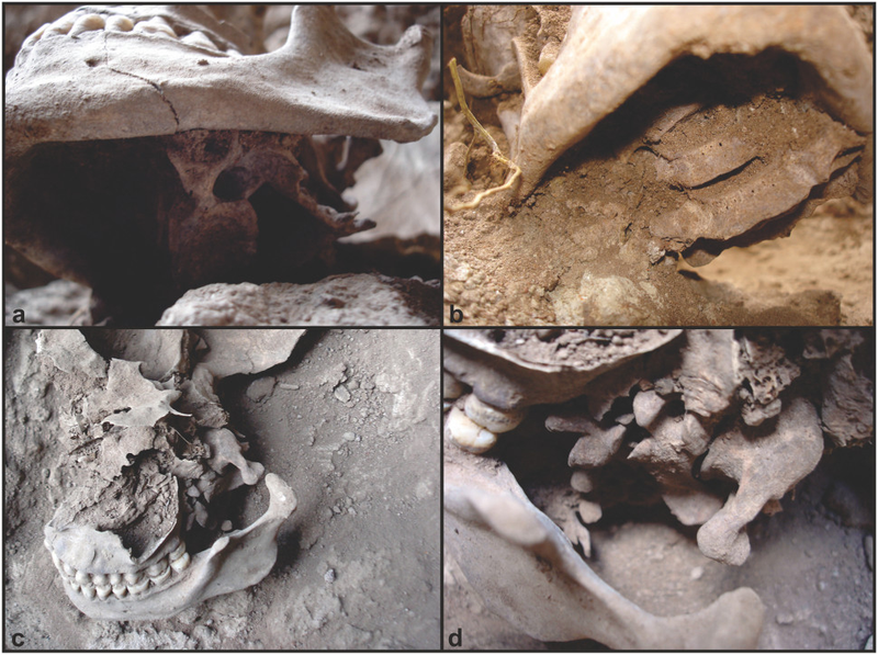 Illustration for article titled This Is the Oldest Case of Ritual Decapitation Ever Uncovered in the Americas